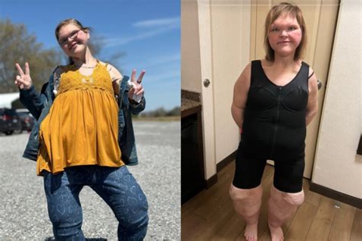 Tammy Slaton now looks unrecognizable in 2023 after weight loss surgery ·